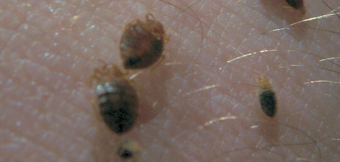 Bed Bugs infestation Birmingham Pest Control Bedbug Infestation